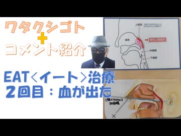 ＥＡＴ（慢性上咽頭炎）治療２度目は出血した←私事【アラ還・読書中毒】コメ：PCR検査意味はあるのでしょうか？インフル検査もですか！インフルエンザワクチンも打ってます。そしてみんなインフルエンザにかかり