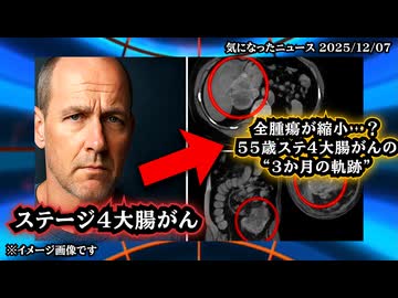 ◆ステージ4大腸がんで“全腫瘍縮小”の衝撃データ ～ イベルメクチン＋メベンダゾール＋CBD＋変性シトラスペクチン…3か月で何が起きたのか？55歳男性の最新症例