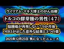 【がん治療】◆トルコの膠芽腫の男性（47）｜脳腫瘍が再発しない？9か月後MRIが示した意外な結果と3つの薬【ウイリアム・マキス博士】