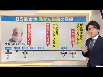 【拡散させて下さい】【大石解説】コロナワクチン接種後に乳がん転移！？／高齢患者と主治医を直撃！患者の体に一体何が…？／接種開始後にがん死者数”下げ止まり”とのデータも