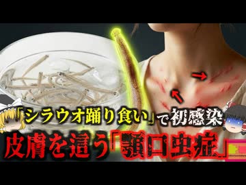 【2022】『皮膚の下を何かが這っている…』医師も困惑した謎の皮膚症状…原因は「シラウオ踊り食い」だった…シラウオに潜む「見えない悪魔」の恐怖…地元の名物が招いた最悪の寄生虫事故【ゆっくり解説】