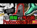【1950】『靴屋で基準の400倍の放射線』科学的に正しい靴選びを！という触れ込みで店に置かれていたX線装置 大量被曝 足が壊死し切断…『ペドスコープ被曝事故』  【ゆっくり解説】
