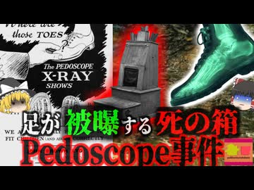 【1950】『靴屋で基準の400倍の放射線』科学的に正しい靴選びを！という触れ込みで店に置かれていたX線装置 大量被曝 足が壊死し切断…『ペドスコープ被曝事故』  【ゆっくり解説】
