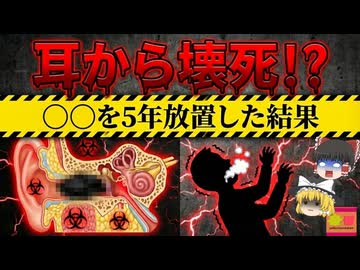 【2019】『耳奥に耳掃除の"綿"が詰まり壊死』5年以上謎の体調不良を訴えていた男性の耳を調べたところ、奥から変色した綿が…「壊死性外耳道炎」