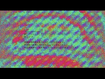 Ophthalmology / ナースロボ＿タイプＴ