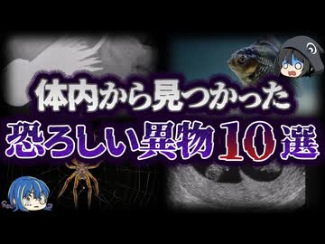 【ゆっくり解説】どうしてこれがここに？人間の体内から発見された異物10選