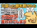 【2ch面白スレ】火傷より腕毛が気になりすぎるスレ民【ゆっくり解説】