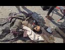 Alive Arab Adult