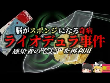 【1980s】『死者の脳膜を再利用』脳手術を受けた患者が次々と「脳がスポンジ化」して亡くなった最悪の医療事故『ライオデュラ事件』を解説