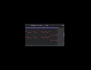 ワールズエンド・ダンスホール remixの中身