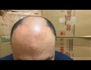 Xでの炎上に関して。らいストさんに対する謝罪と、疑問点。