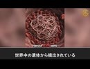 COVID-19ワクチン接種者の100％にプリオン様アミロイド微小血栓　巨大白色線維性血栓へと蓄積