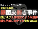 顔面皮剥ぎ事件『誰も予想しなかった驚愕の結末』