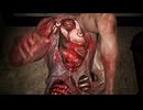 【米砂原醫院＃2】ドパガキの悪魔