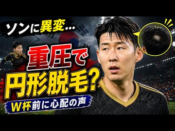 ソン･フンミン､ハゲる...｢どれだけすごいストレスなのか｣と韓国嗚咽【サッカー】
