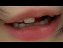 【うなぁ】歯医者に行きたい件　等【ニコ生】