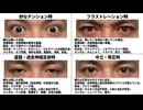 「アクセル系のホルモン」の分解に、マグネシウム、ビタミン、肝臓のケア