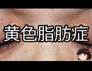 【ゆっくり朗読】ゆっくりさんと不思議な病気 その775