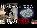 【2016】『目の中から27枚のコンタクト』白内障手術を受けていた女性の目から、大量の古いコンタクトレンズの塊が見つかる…医学界に衝撃を与えた奇妙な事例を解説