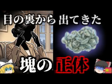 【2016】『目の中から27枚のコンタクト』白内障手術を受けていた女性の目から、大量の古いコンタクトレンズの塊が見つかる…医学界に衝撃を与えた奇妙な事例を解説