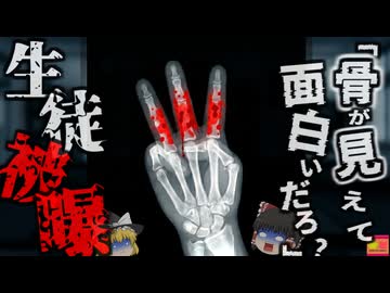 【2001】教師「X線で手の骨を見てみよう!」→生徒の指が大量被曝し急性放射線炎に…杜撰な管理に無知な教師による悲劇…『岩手県公立高校X線照射事故』を解説（ﾘﾒｲｸ