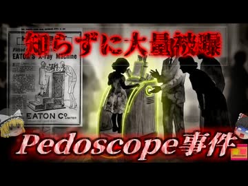 【1950】『画期的なフィッティング装置です!』→X線で足の骨を透過し最適な靴を選ぶ最新式装置。しかし、知らない間に使用者が大量被曝し…『ペドスコープの悲劇』を解説（ﾘﾒｲｸ
