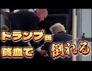20260904_トランプ大統領、貧血で倒れる！？