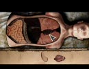 【SILENTHILL ZERO】　を実況するけど異論は認める　part4
