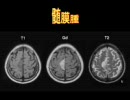 神経内科画像診断